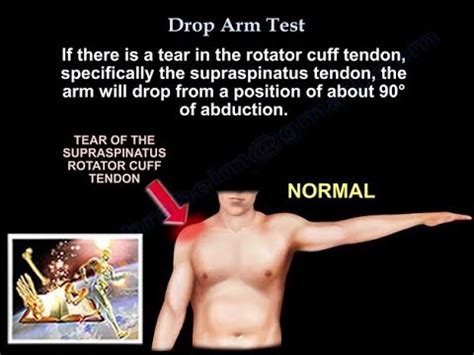 test for labral tear of shoulder|how to tell if you tore your rotator cuff.